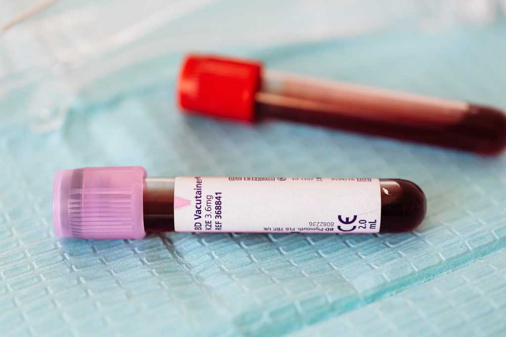 Blut abnehmen nüchtern – Antworten auf wichtige Fragen + ...